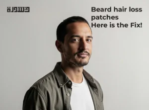 Beard hair loss patches