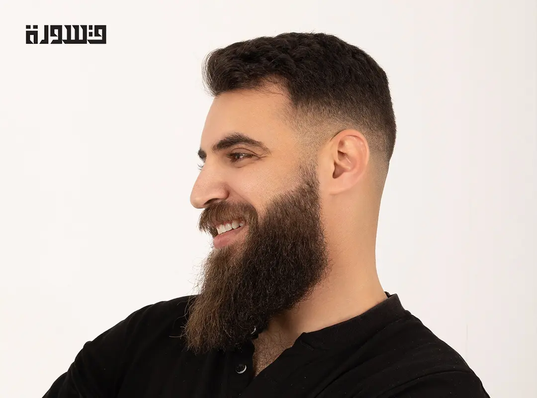 تساقط شعر اللحية